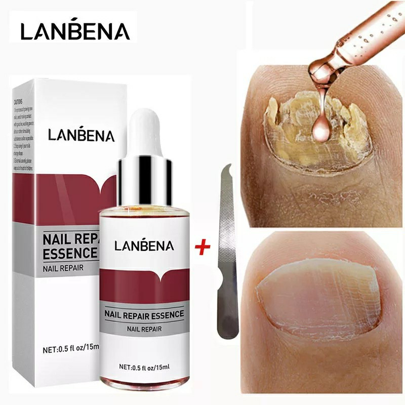 LANBENA Nail Repair Essence Serum